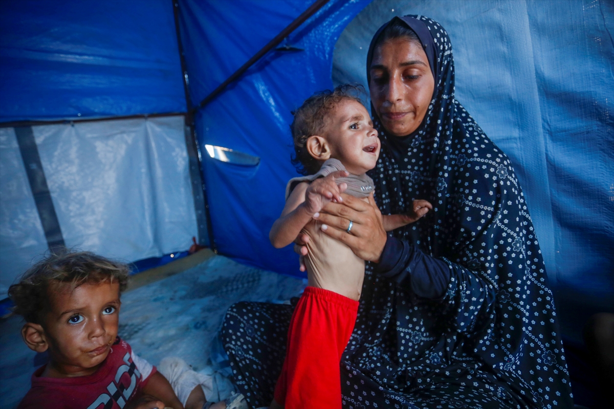 Gazze'de bebekler beslenme sıkıntısı yaşıyor