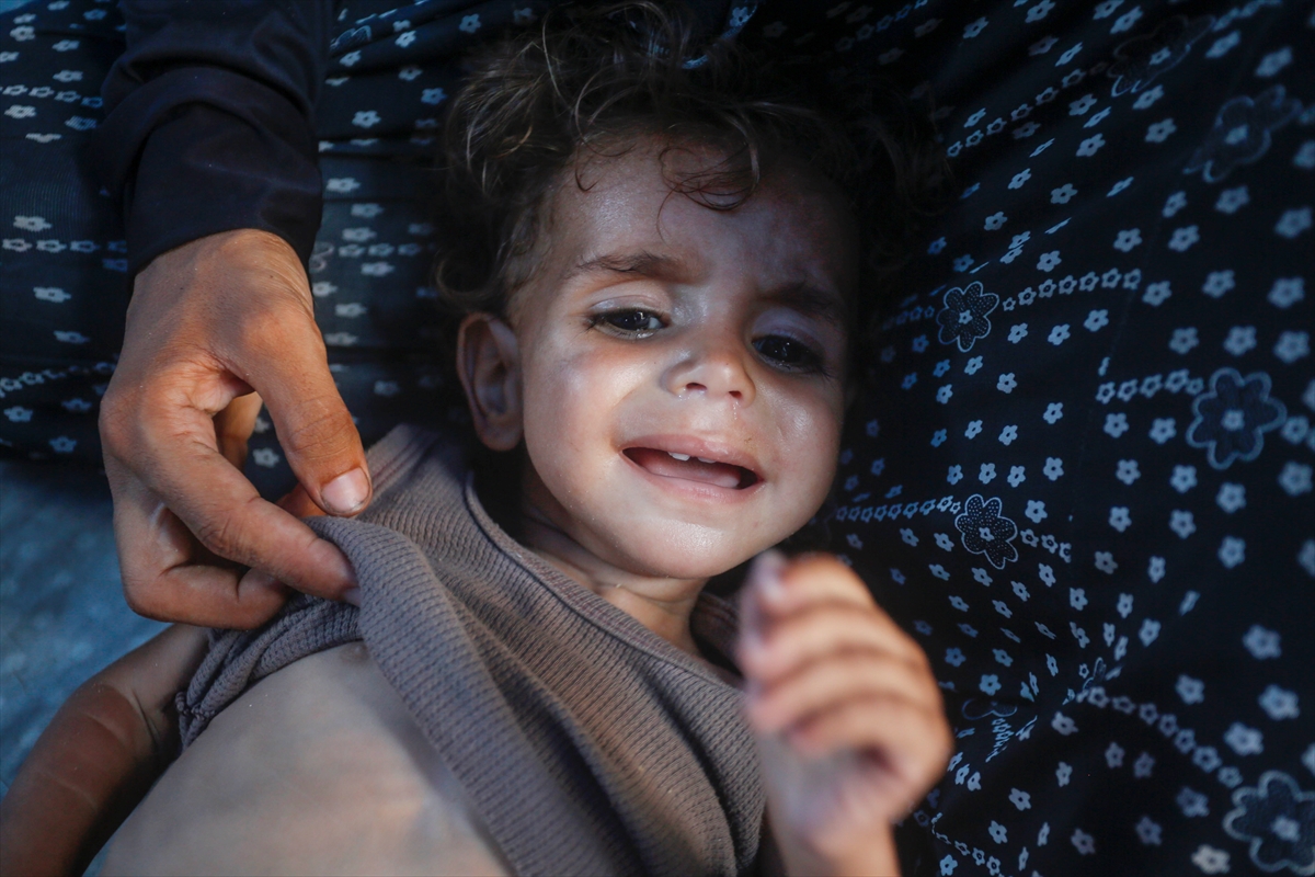 Gazze'de bebekler beslenme sıkıntısı yaşıyor