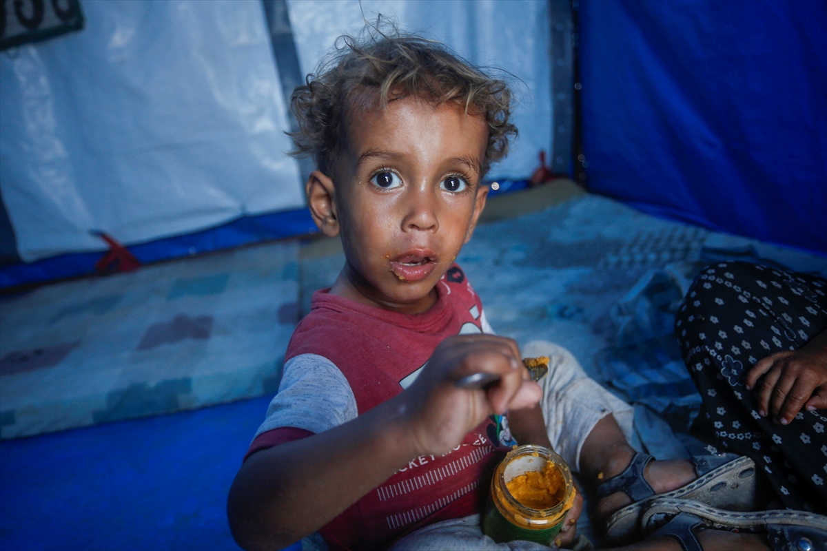 Gazze'de bebekler beslenme sıkıntısı yaşıyor