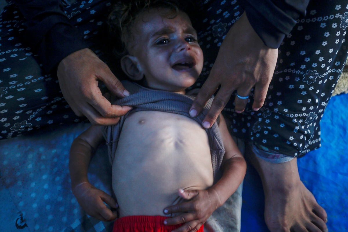 Gazze'de bebekler beslenme sıkıntısı yaşıyor