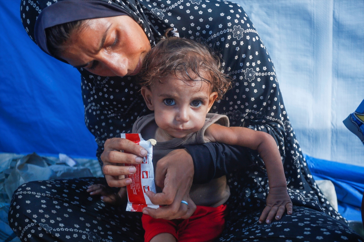 Gazze'de bebekler beslenme sıkıntısı yaşıyor