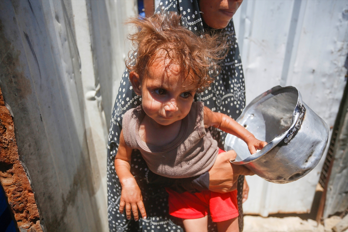 Gazze'de bebekler beslenme sıkıntısı yaşıyor