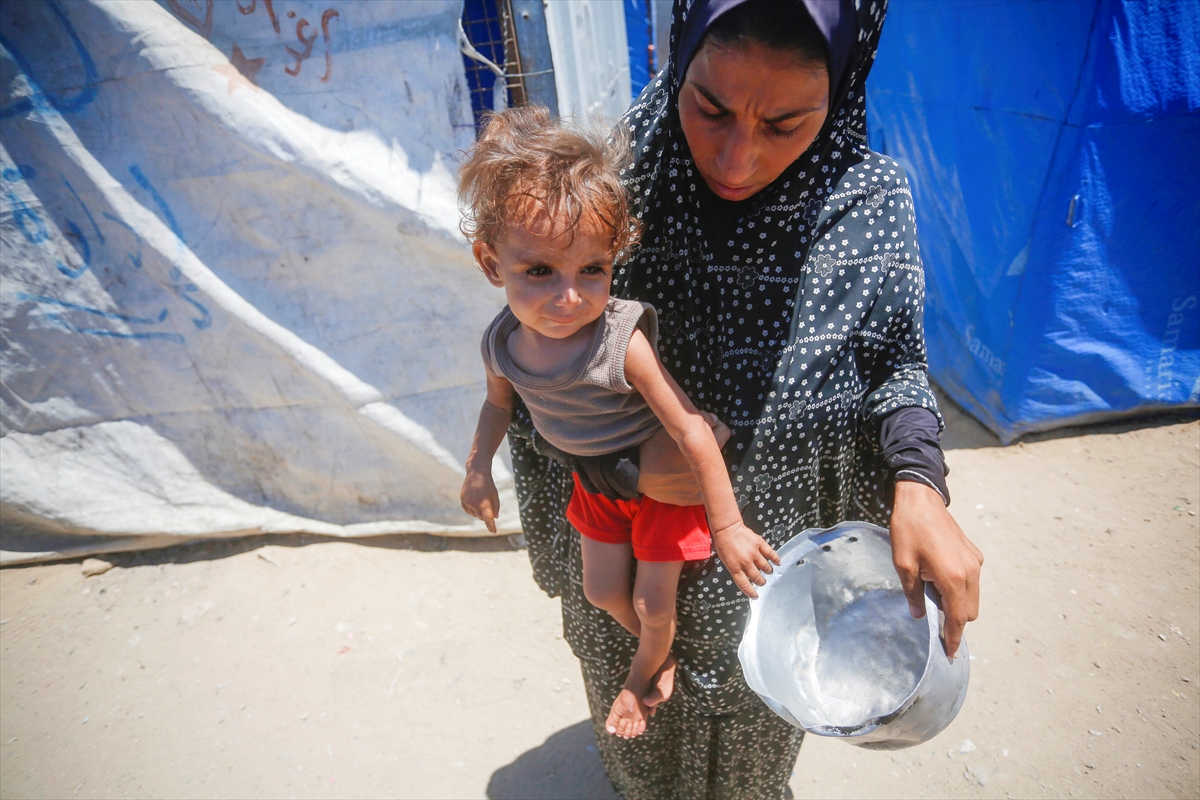 Gazze'de bebekler beslenme sıkıntısı yaşıyor