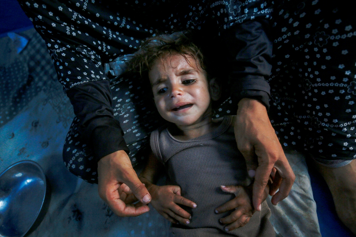 Gazze'de bebekler beslenme sıkıntısı yaşıyor