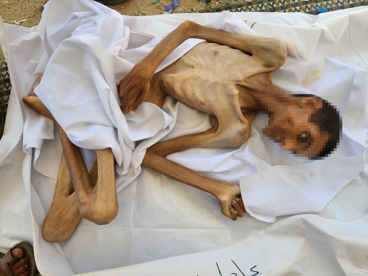 Gazze'de çocukların açlıkla imtihanı