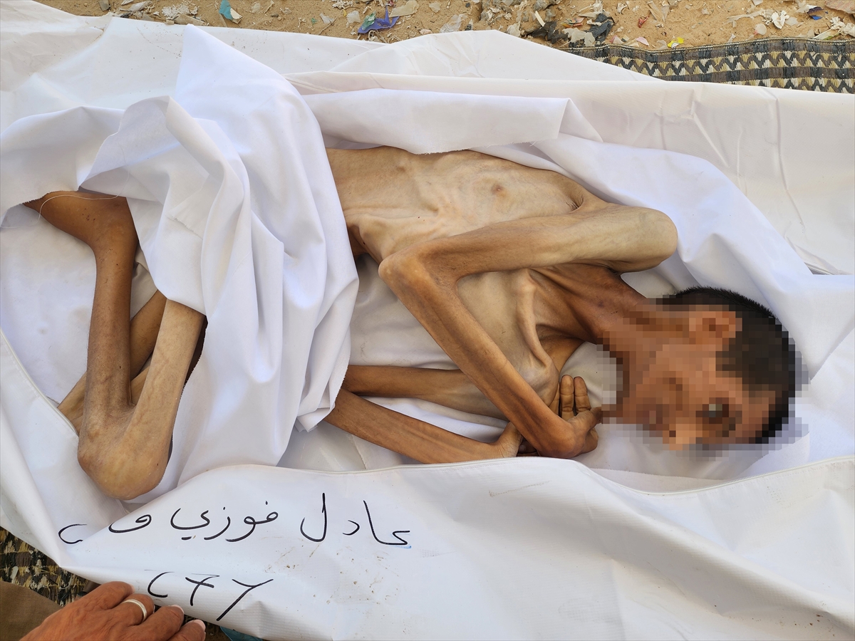 Gazze'de çocukların açlıkla imtihanı