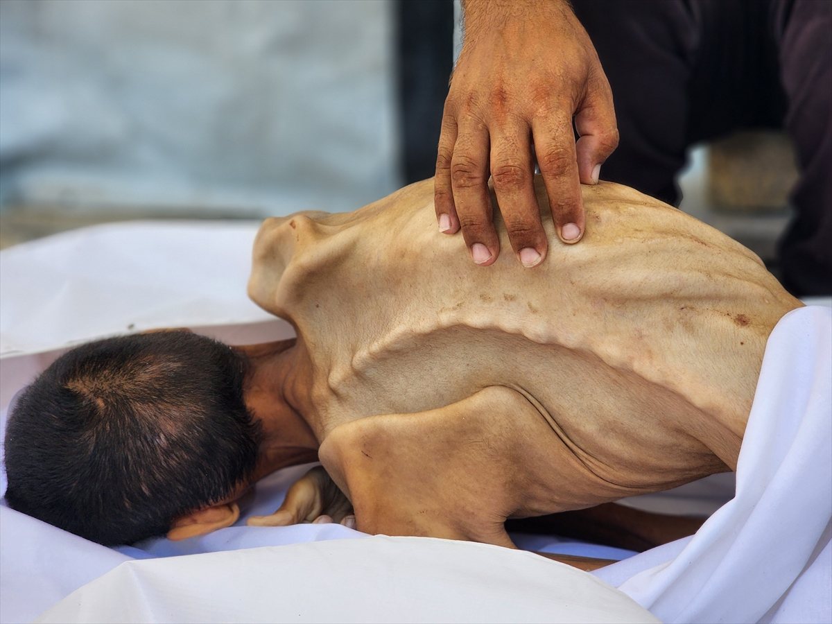 Gazze'de çocukların açlıkla imtihanı