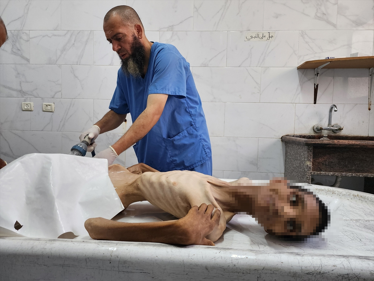 Gazze'de çocukların açlıkla imtihanı