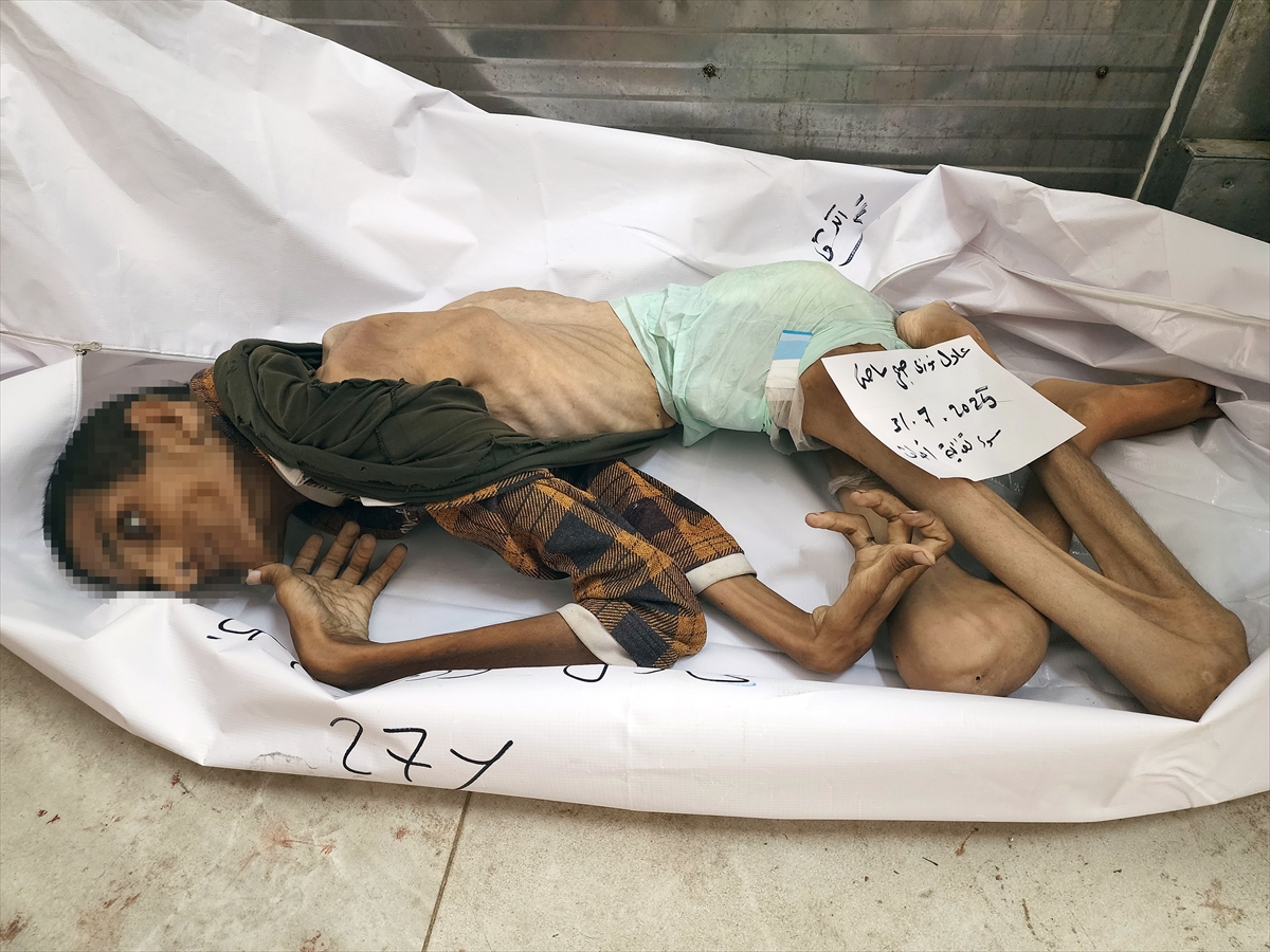 Gazze'de çocukların açlıkla imtihanı