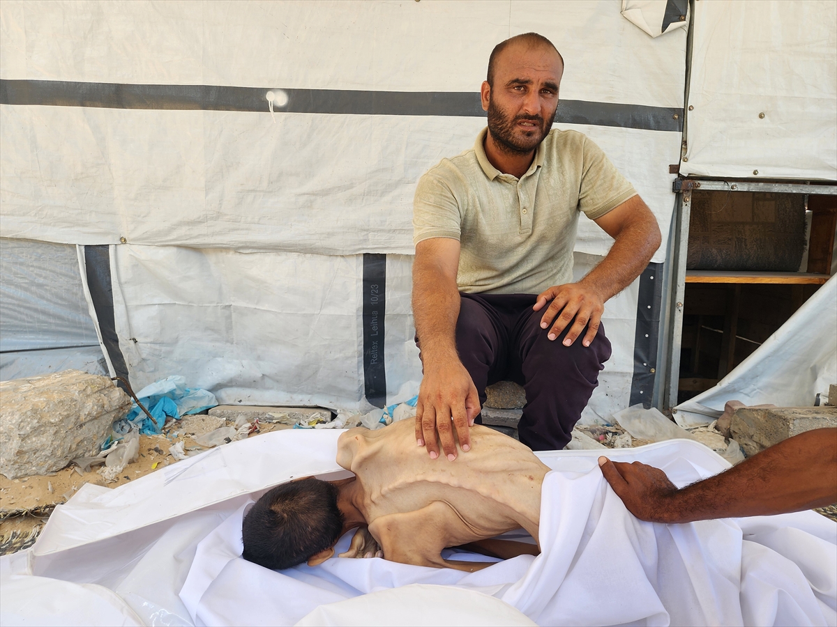 Gazze'de çocukların açlıkla imtihanı