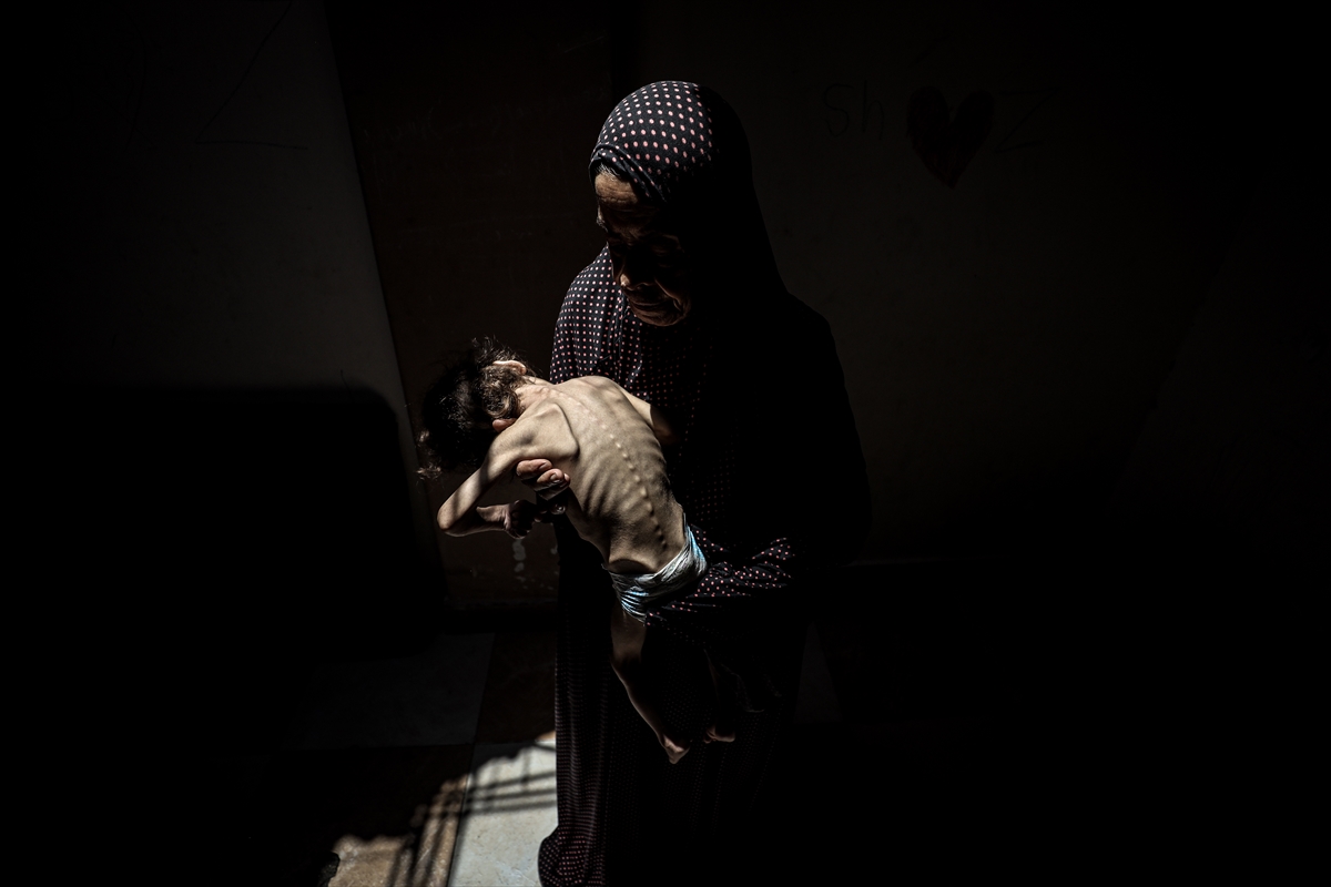 Gazze'de çocukların açlıkla imtihanı