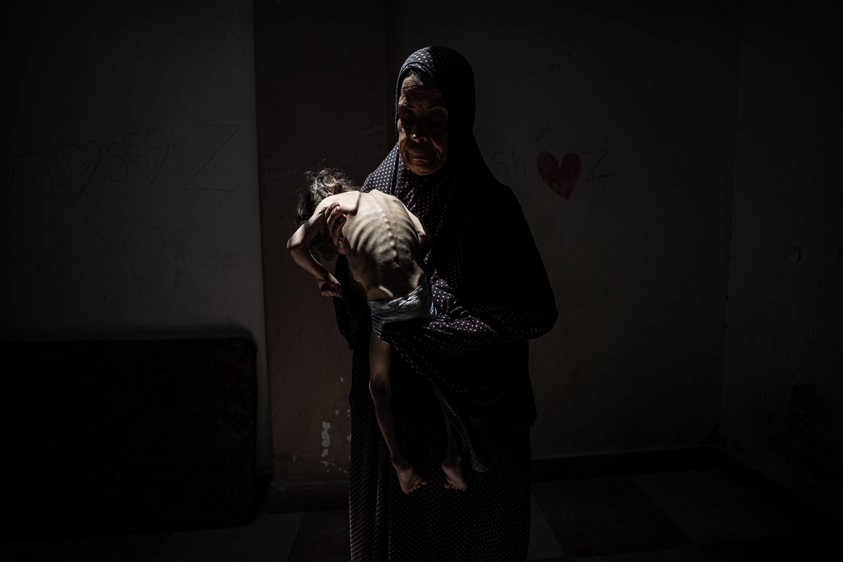 Gazze'de çocukların açlıkla imtihanı