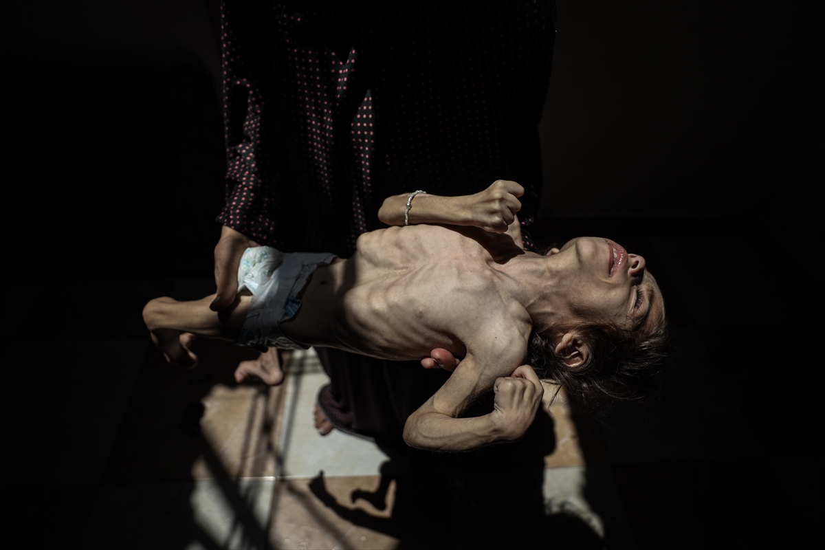 Gazze'de çocukların açlıkla imtihanı