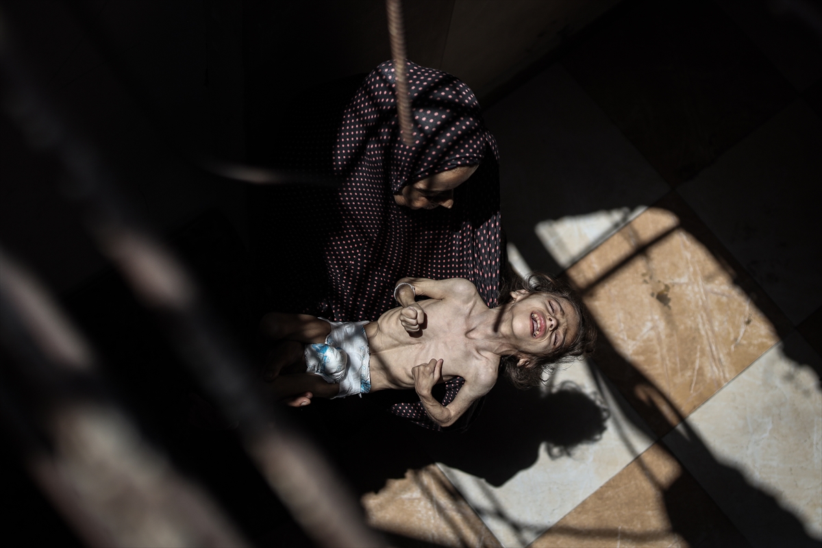 Gazze'de çocukların açlıkla imtihanı