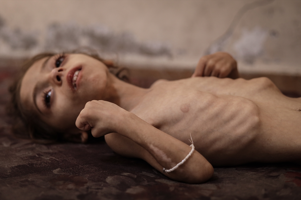 Gazze'de çocukların açlıkla imtihanı