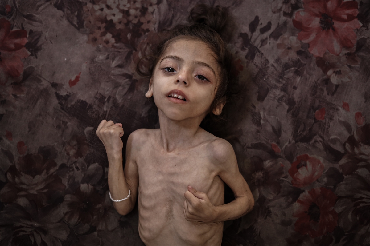 Gazze'de çocukların açlıkla imtihanı