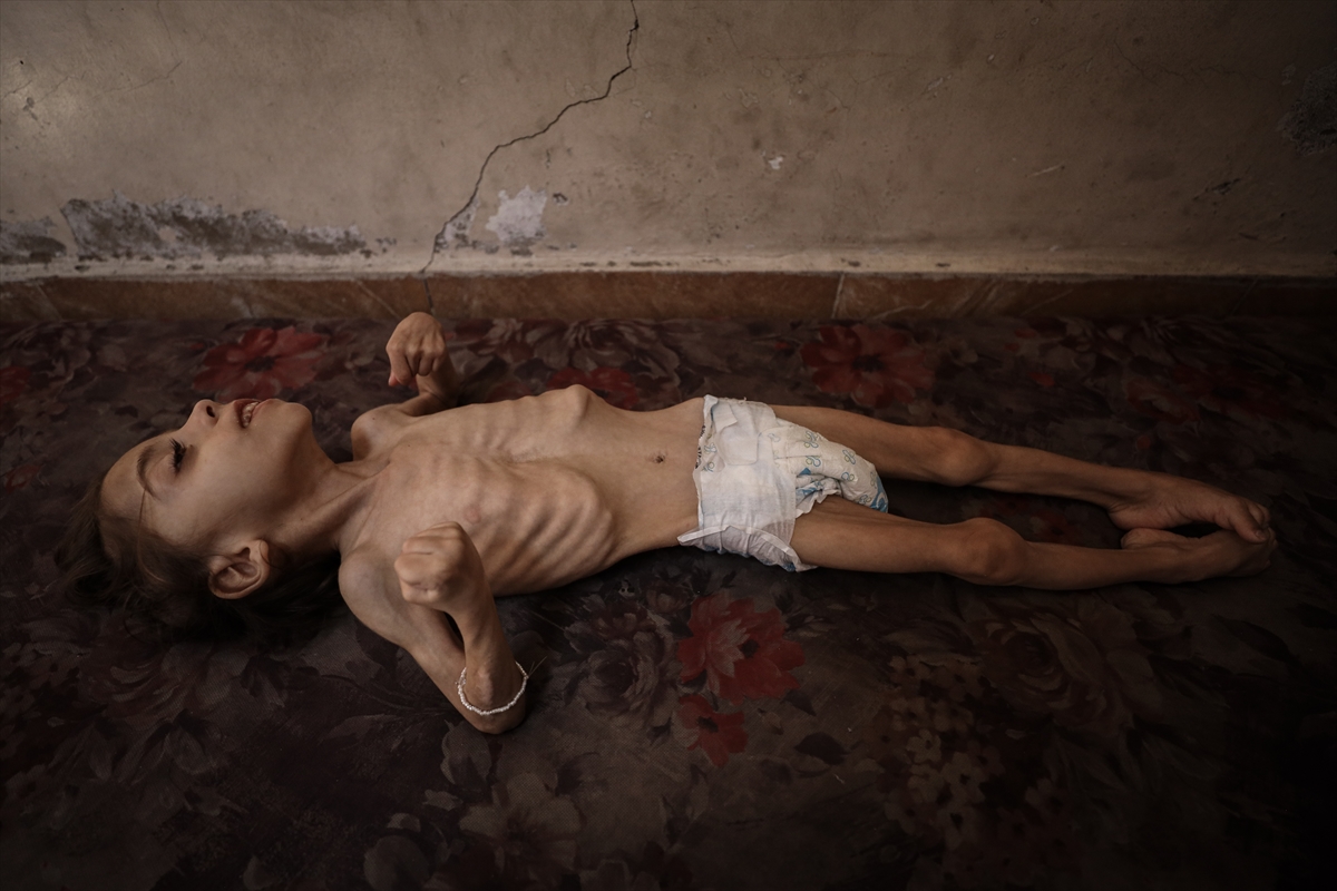 Gazze'de çocukların açlıkla imtihanı