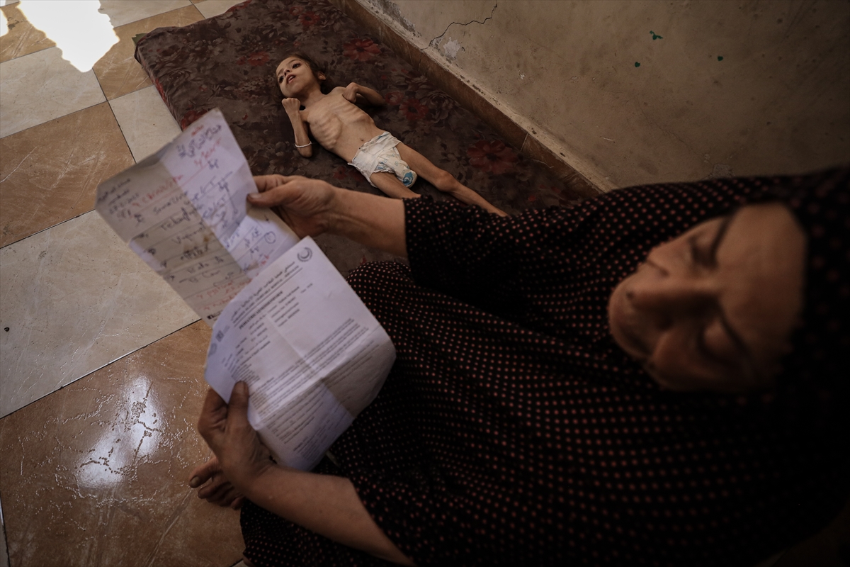 Gazze'de çocukların açlıkla imtihanı