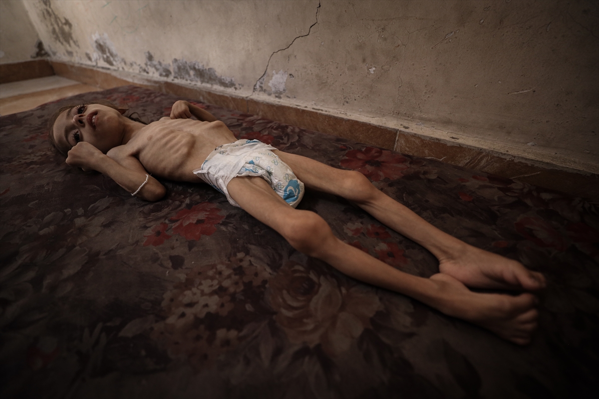 Gazze'de çocukların açlıkla imtihanı