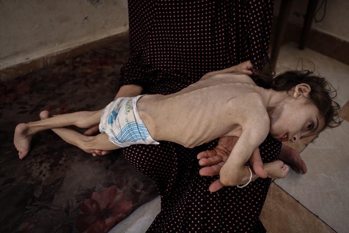 Gazze'de çocukların açlıkla imtihanı