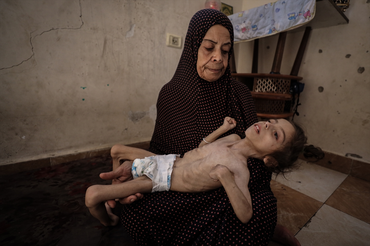 Gazze'de çocukların açlıkla imtihanı