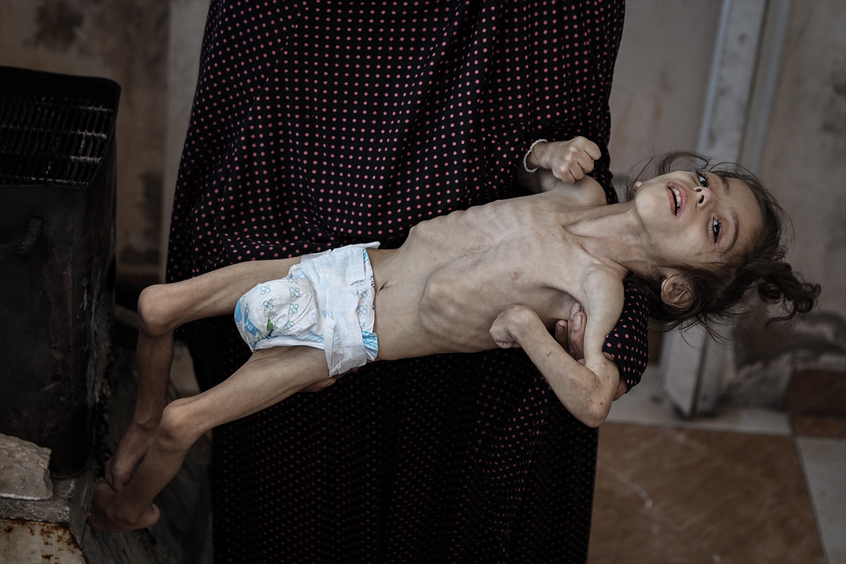 Gazze'de çocukların açlıkla imtihanı