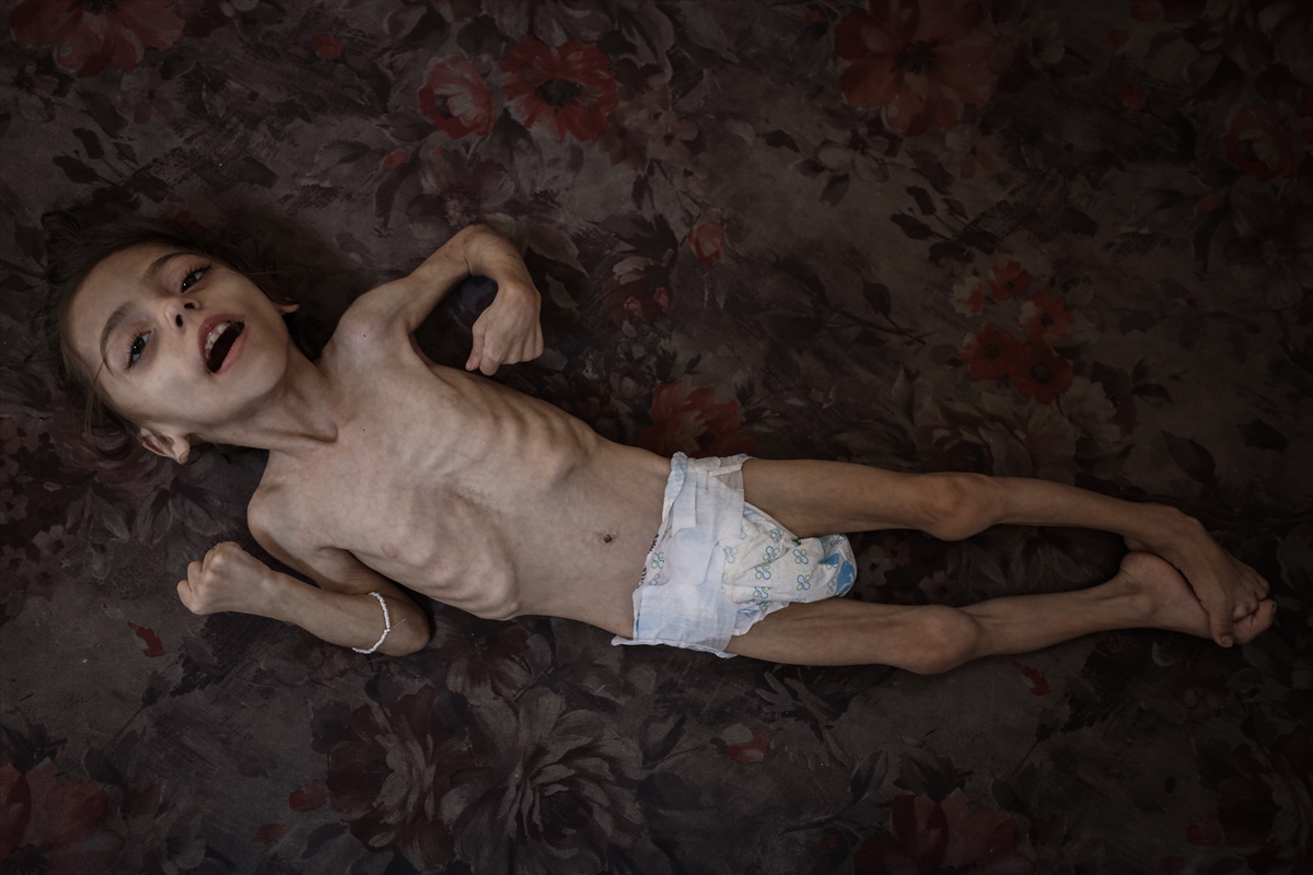 Gazze'de çocukların açlıkla imtihanı