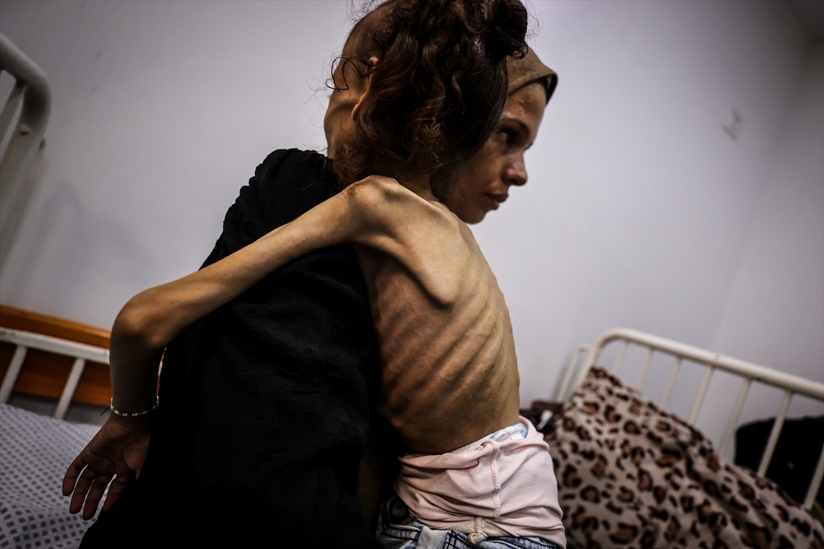 Gazze'de çocuklar ve bebekler açlıkla mücadele ediyor