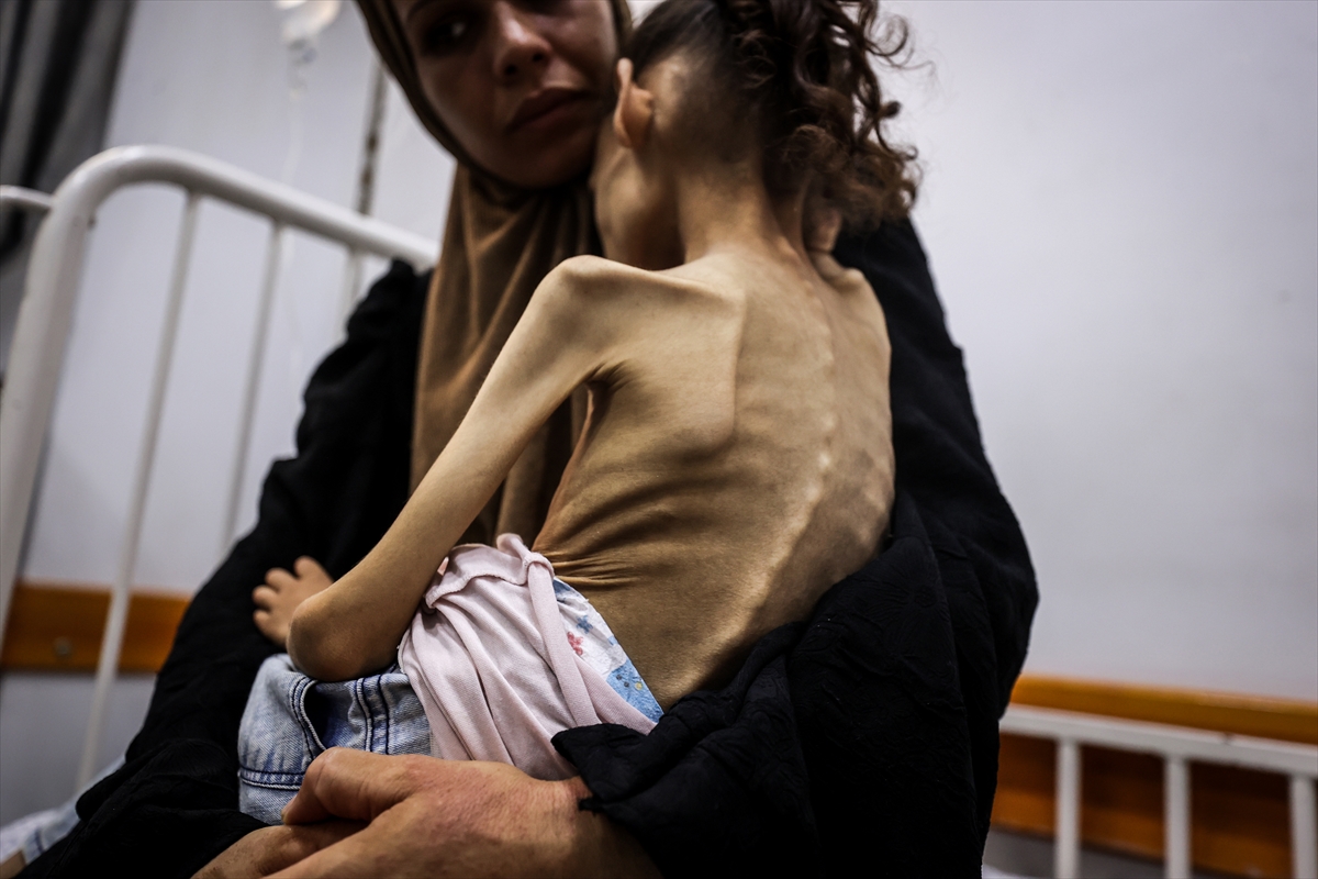 Gazze'de çocuklar ve bebekler açlıkla mücadele ediyor