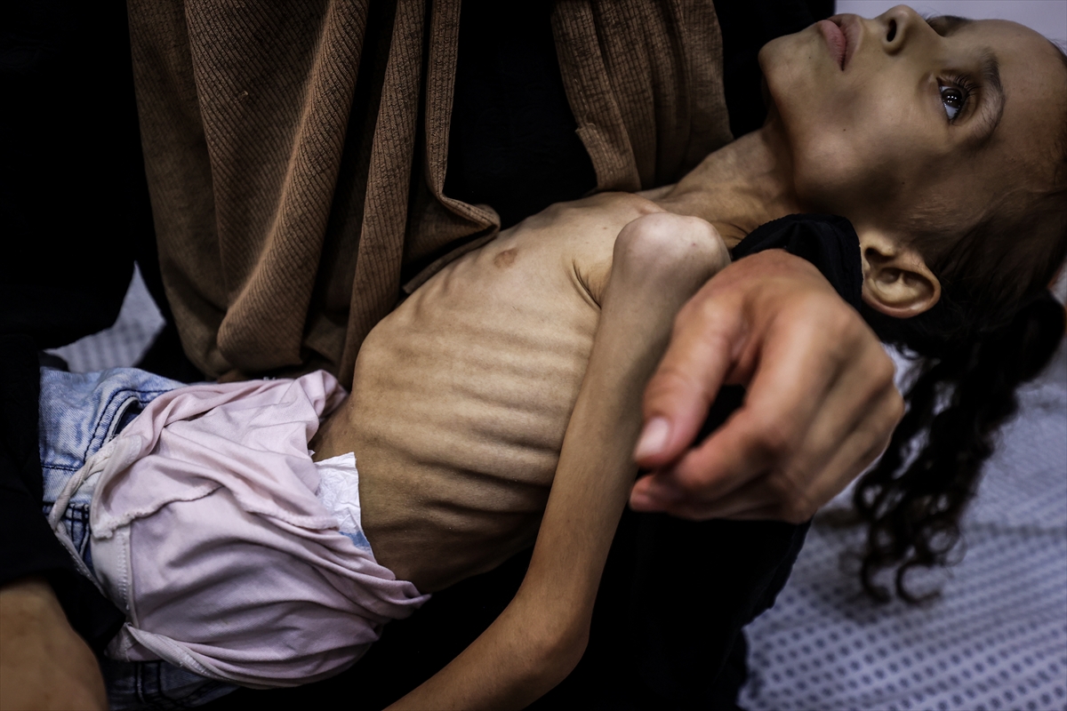 Gazze'de çocuklar ve bebekler açlıkla mücadele ediyor