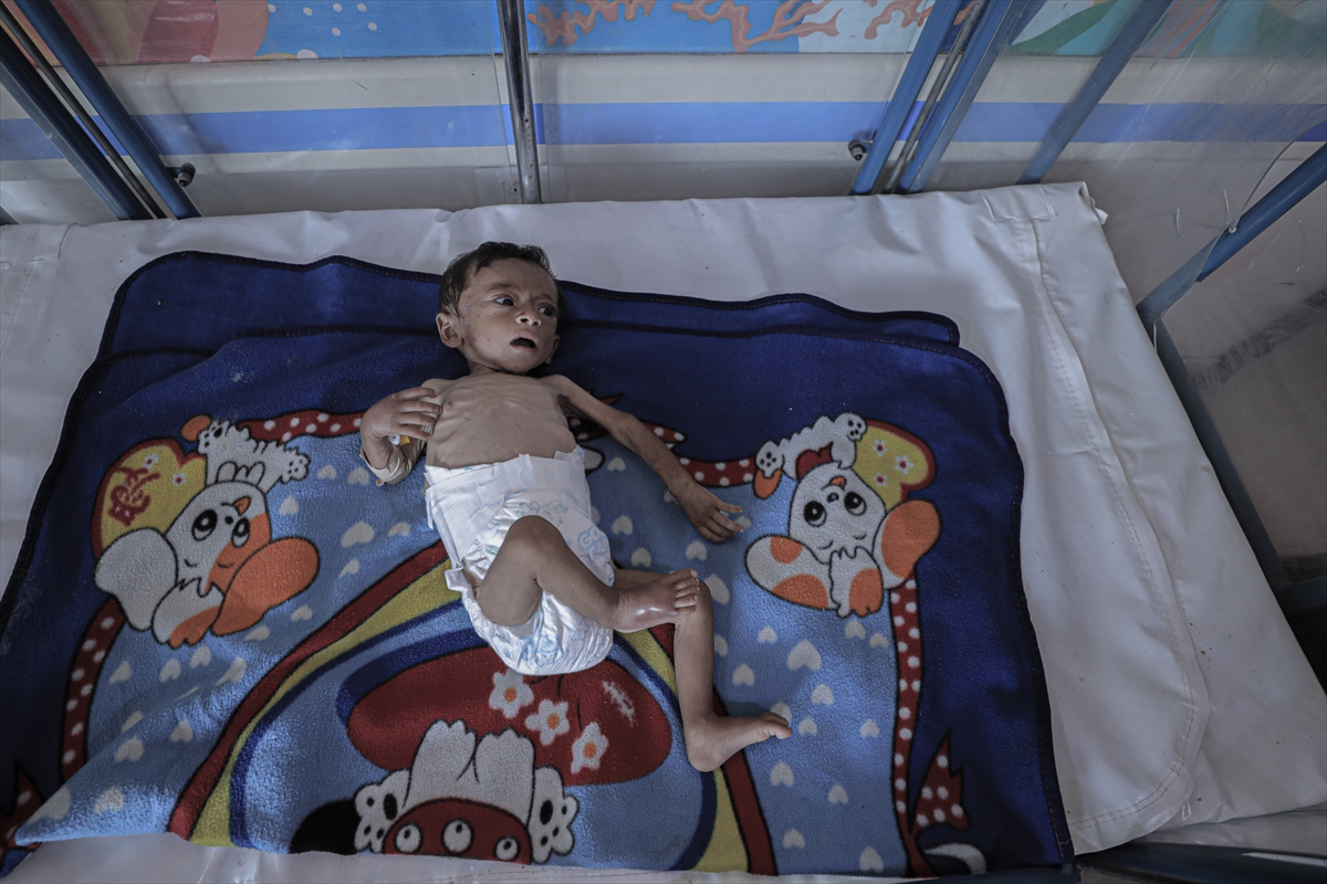 Gazze'de çocuklar ve bebekler açlıkla mücadele ediyor