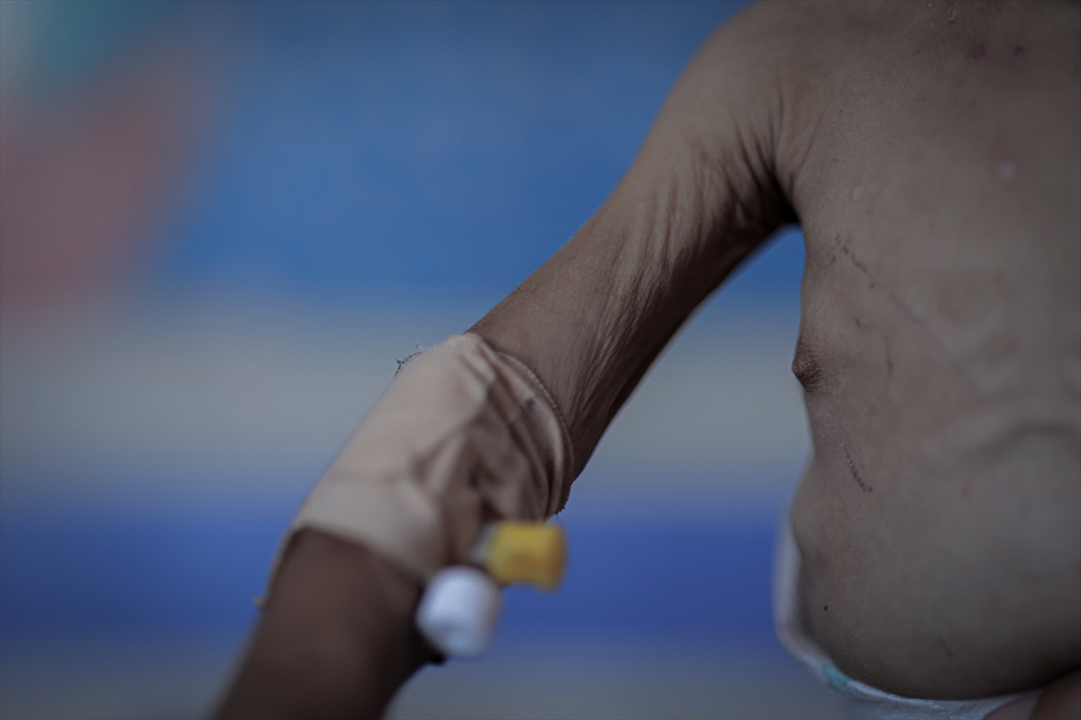 Gazze'de çocuklar ve bebekler açlıkla mücadele ediyor