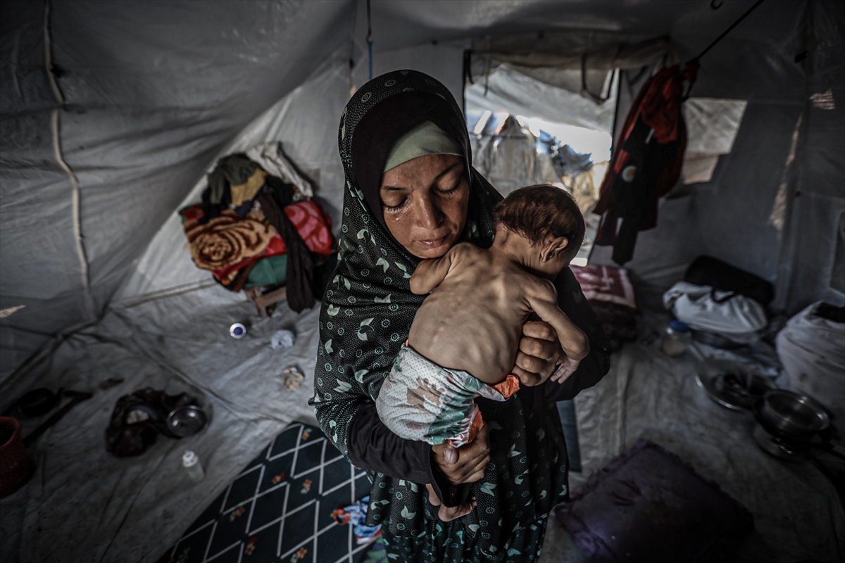 Gazze'de çocuklar ve bebekler açlıkla mücadele ediyor