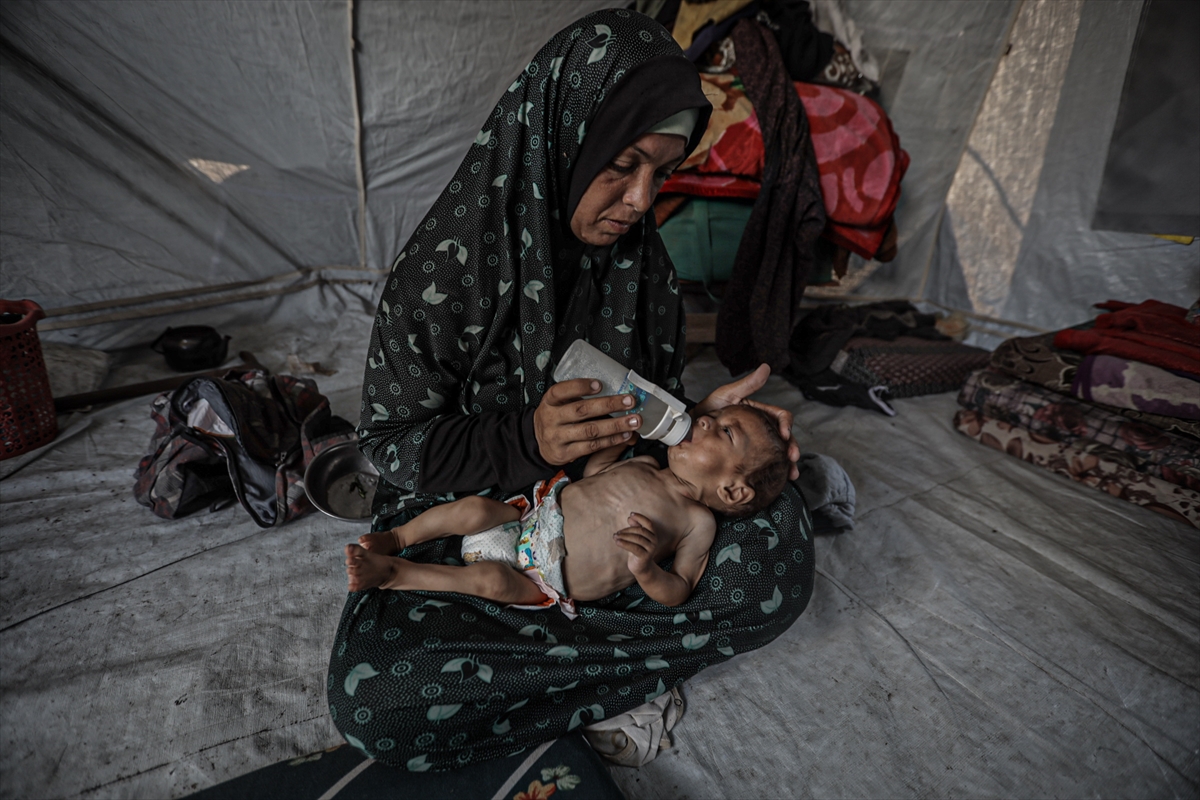 Gazze'de çocuklar ve bebekler açlıkla mücadele ediyor