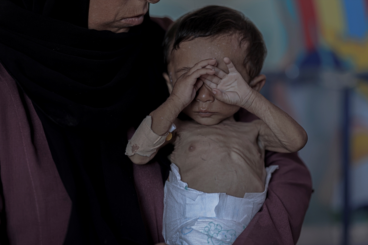 Gazze'de çocuklar ve bebekler açlıkla mücadele ediyor