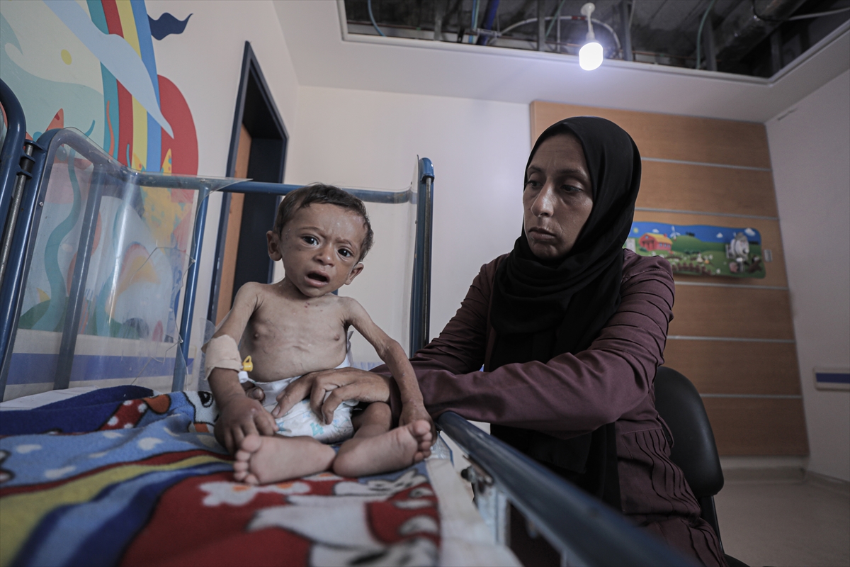 Gazze'de çocuklar ve bebekler açlıkla mücadele ediyor