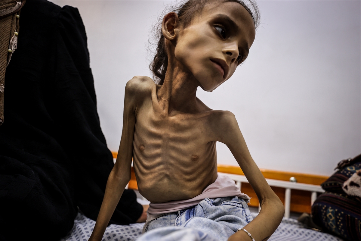 Gazze'de çocuklar ve bebekler açlıkla mücadele ediyor