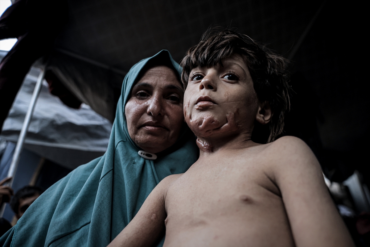 İsrail saldırısının hedefi olan çocuklardan biri: Muhammed