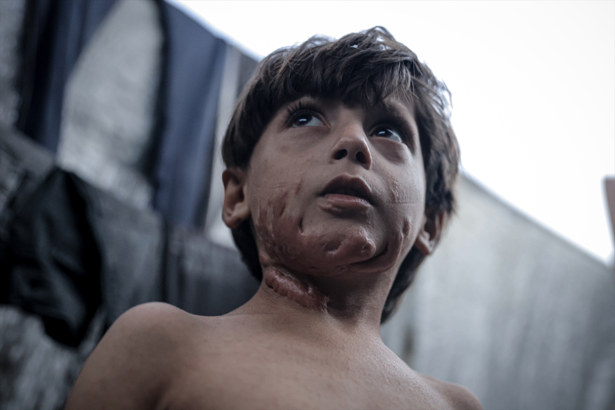 İsrail saldırısının hedefi olan çocuklardan biri: Muhammed