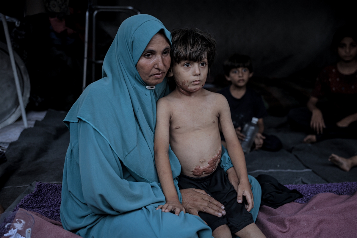 İsrail saldırısının hedefi olan çocuklardan biri: Muhammed