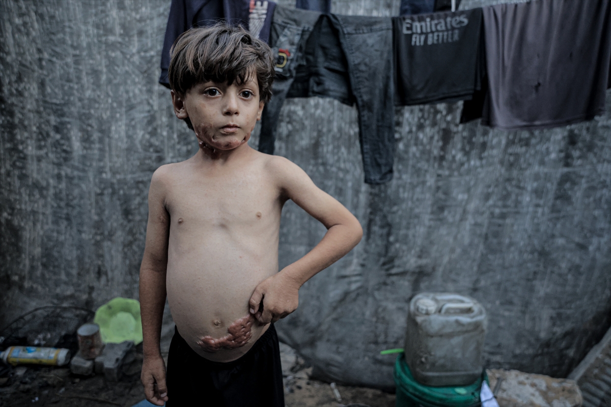 İsrail saldırısının hedefi olan çocuklardan biri: Muhammed