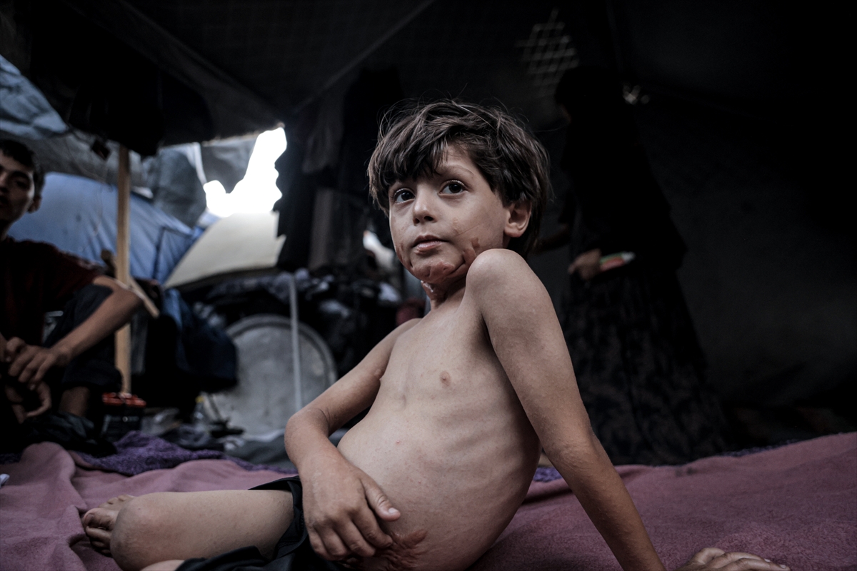 İsrail saldırısının hedefi olan çocuklardan biri: Muhammed