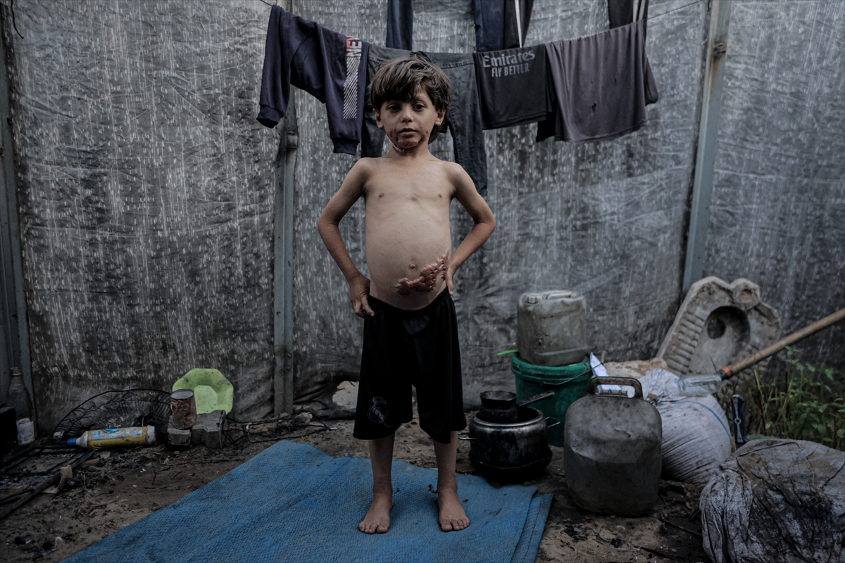 İsrail saldırısının hedefi olan çocuklardan biri: Muhammed