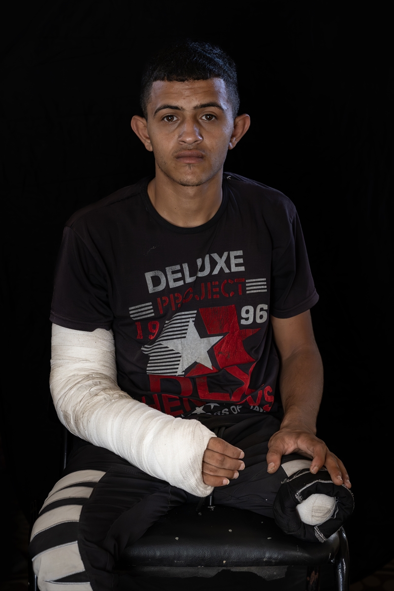 Gazze'de binlerce çocuk İsrail saldırılarında uzuvlarını kaybetti