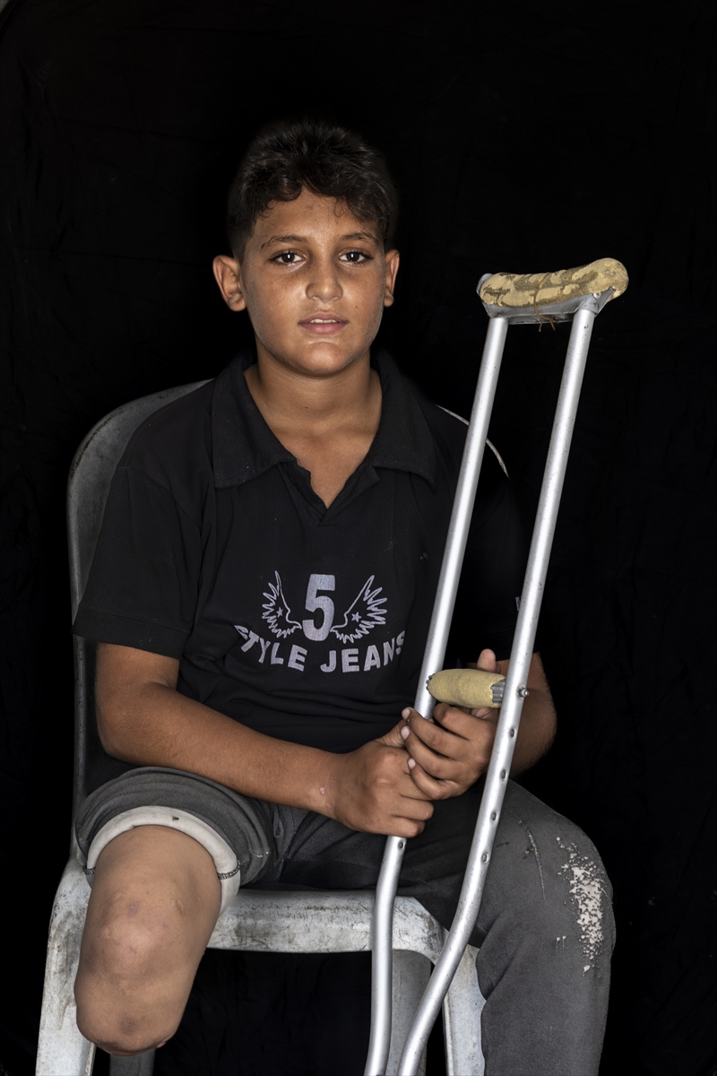 Gazze'de binlerce çocuk İsrail saldırılarında uzuvlarını kaybetti