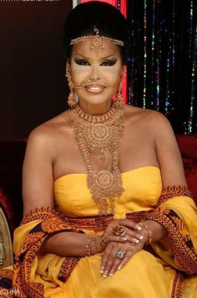 Bülent Ersoy bir haftadır tedavi görüyor 