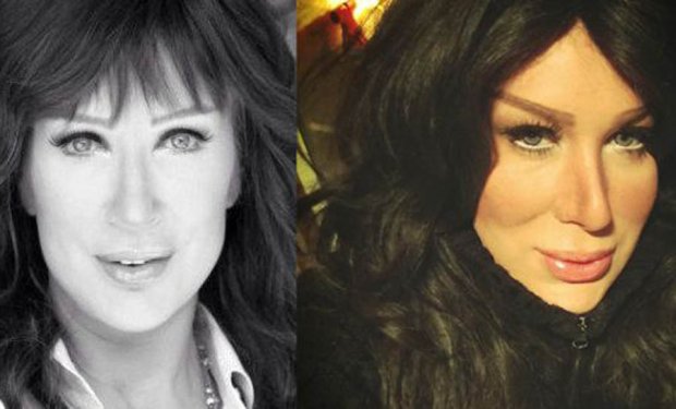 Transeksüel utku ameliyatla Seda Sayan'a benzedi