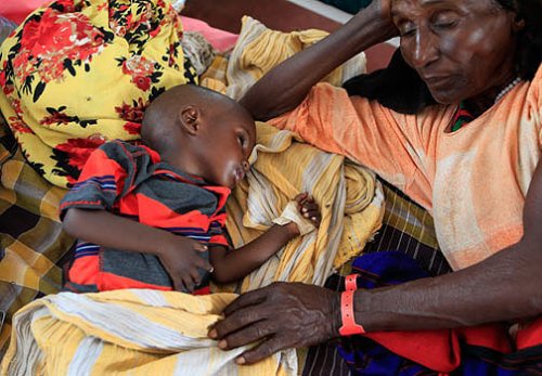 Somali dünyanın en feci felaketini yaşıyor