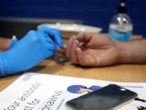 Birleşik Krallık, evde antikor testi programını başlatacak