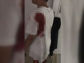 Sultangazi’de oyun oynayan çocuk, yorgun mermiyle vuruldu